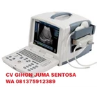 USG (Ultrasonografi) Murah  1