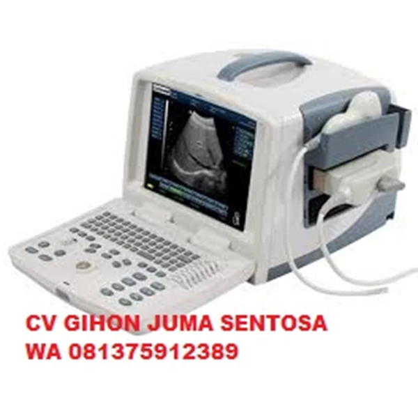 USG (Ultrasonografi) Murah 