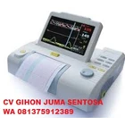 Elektrokardiograf (EKG) / Alat Rekam Jantung Murah  1