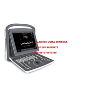 Portable 12.1 inch screen B/W Ultrasound Scanner with PW function Ultrasonic Scanner Ultrasound machine